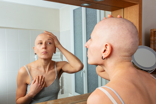 Reflective woman with baldness observe her likeness in mirror