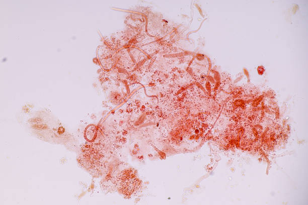 Host cells with spores (mold) are inside wood under the microscope for education. Host cells with spores (mold) are inside wood under the microscope for education. conidia stock pictures, royalty-free photos & images