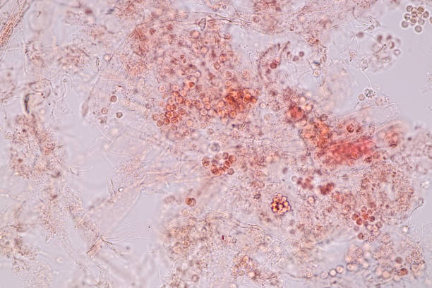 Host cells with spores (mold) are inside wood under the microscope for education. Host cells with spores (mold) are inside wood under the microscope for education. conidia stock pictures, royalty-free photos & images