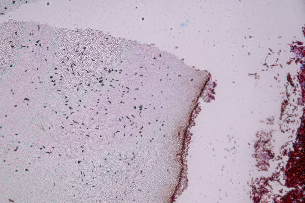 Host cells with spores (mold) are inside wood under the microscope for education. Host cells with spores (mold) are inside wood under the microscope for education. conidia stock pictures, royalty-free photos & images