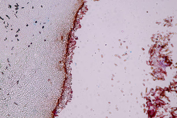 Host cells with spores (mold) are inside wood under the microscope for education.