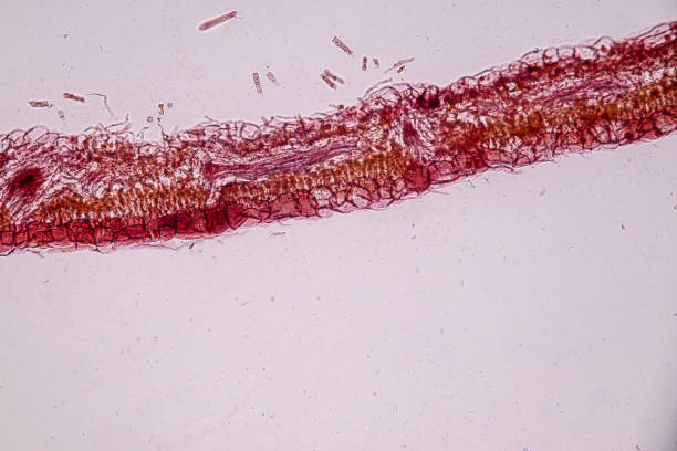 Host cells with spores (mold) are inside wood under the microscope for education.