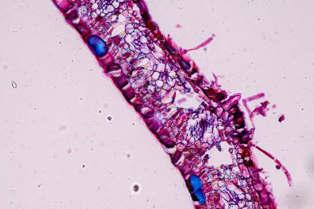istock Host cells with spores (mold) are inside wood under the microscope for education. 1996570448