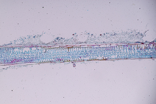Host cells with spores (mold) are inside wood under the microscope for education.