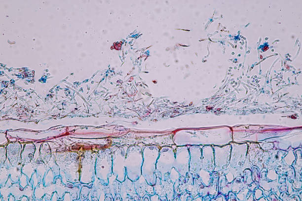 istock Host cells with spores (mold) are inside wood under the microscope for education. 1996570460