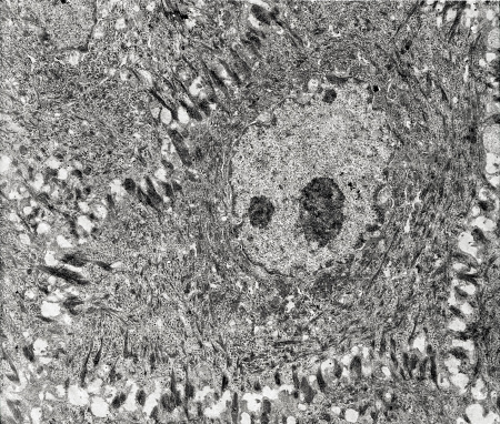 Bacteria outbreak and bacterial infection as a microscopic background as dangerous disease strain case as a medical health risk concept with disease cells as a 3D render.