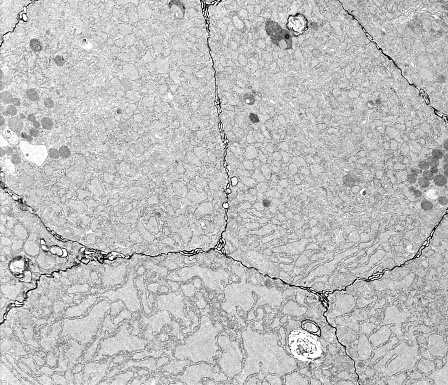 The narrow intercellular space between epithelial cells can be filled with electron dense markers such as lanthanum nitrate. This electron-dense cation, which binds avidly to calcium binding sites, can be used as tracer for delineating extracellular spaces and intercellular junctions. This electron microscope micrograph shows the intercellular clefts between epithelial cells of a pancreas.