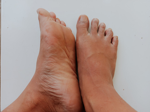 A pair of male feet