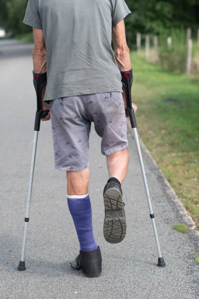 istock A man with a broken leg is walking down the street, on his left leg he has a special boot for walking 1998094522