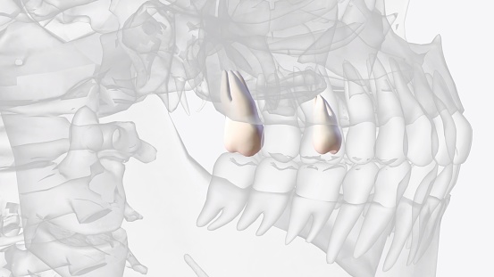 The maxillary third molar is the most distal tooth in the arch and anatomically approximates the floor photo