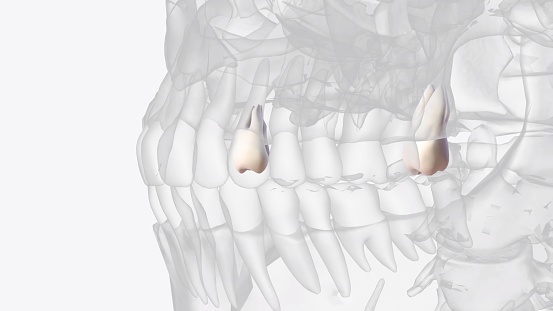 El tercer molar maxilar es el diente más distal de la arcada y anatómicamente se aproxima al suelo photo