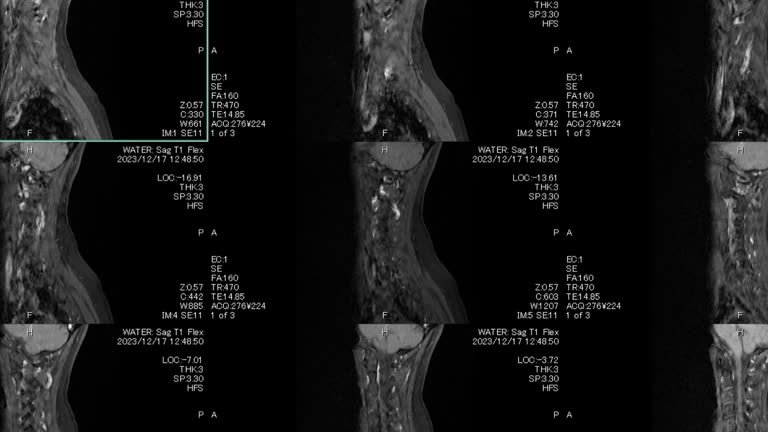 A computerized tomography (CT) scan combines a series of X-ray.