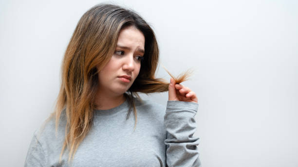 istock young woman have hair loss problem 2002107158