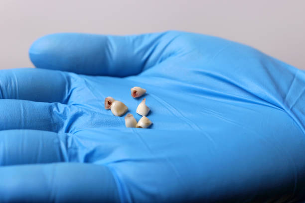 istock Milk teeth in a gloved hand. Dentistry and dental care. 2003147263