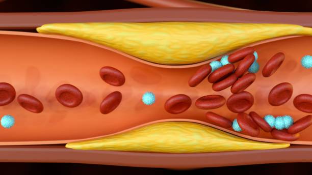 plaque formation of cholesterol in artery - cytoplazma zdjęcia i obrazy z banku zdjęć