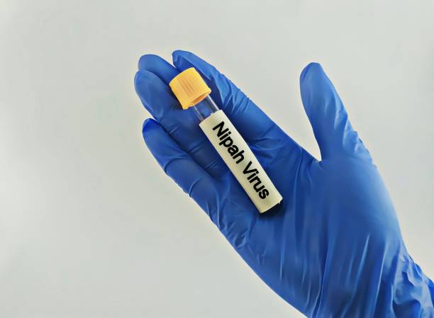 istock Blood samples isolated on white background for Nipah virus test. 2005470408