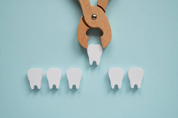 istock Toy wooden teeth on a blue background. Toy wooden teeth on a turquoise. Pull or remove tooth medical concept. 2005729391