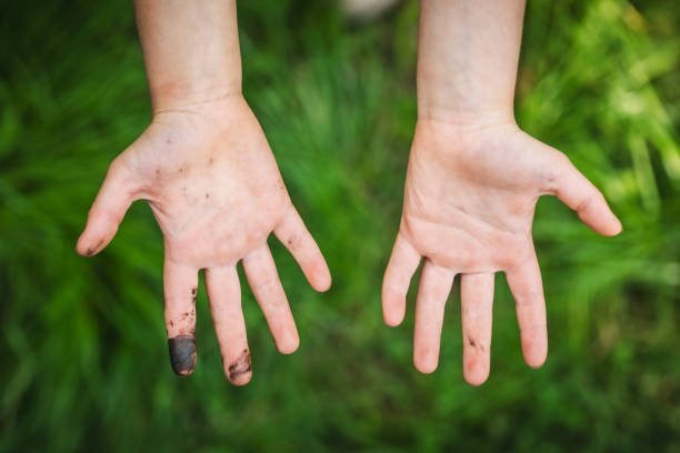 Child shows filthy hands outdoors