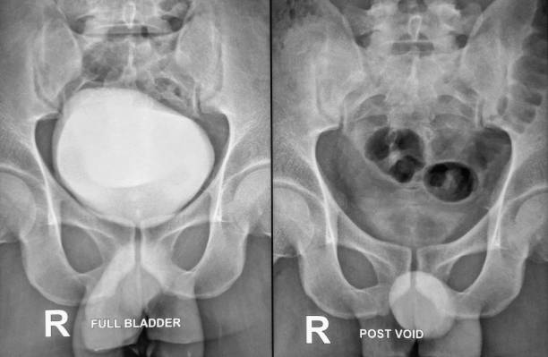 istock X-ray of the RGU and MCU. 2007700168