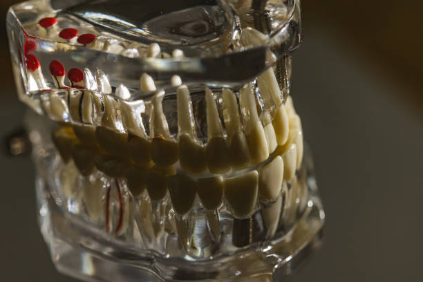 Model of human jaw. Selective Focus.
