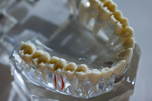 3D scanning of denture model