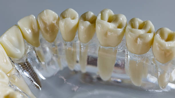 istock Model of human jaw. Selective Focus 2008339180