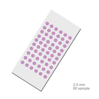 The sample slide of tissue microarray (TMA) technique was staining for target detection.