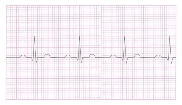 istock The picture of Electrocardiogram (ECG) or Electrocardiography (EKG) that plotted the curve on a graph paper to check up the heartbeat. 2009084567