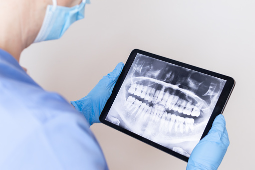 unrecognizable doctor with a dental x-ray on the screen of a digital tablet.dentist working in the clinic.revision of a tooth radiography.