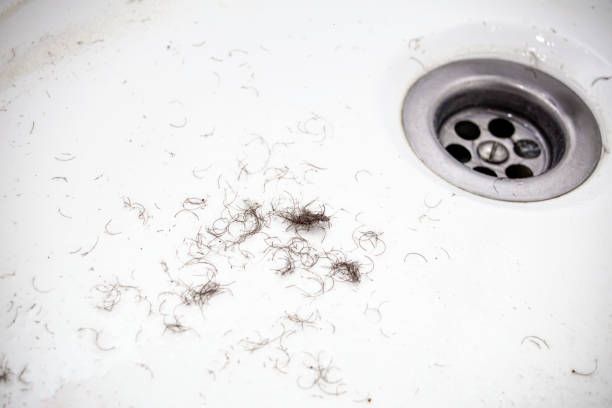 shaved hair from the intimate areas of the pubic area after shaving and depilation remaining on the walls of the bathroom sink, close-up texture - rust covered imagens e fotografias de stock