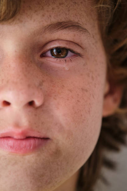 istock Crop crying boy with freckles on face skin 2012497610