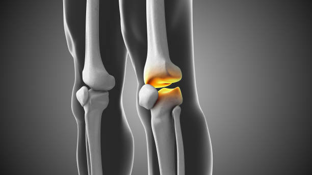 istock Knee joint pain with a gap medical animation 2014270267