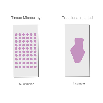The technique comparison between Traditional method and Tissue microarray (TMA) for target detection in pathology principle.