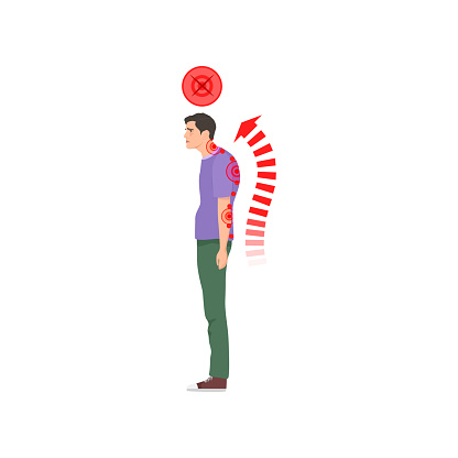 Standing man with incorrect spine posture. Spine health, bad body pose cartoon vector illustration