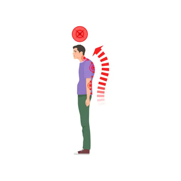 Vector illustration of Standing man with incorrect spine posture