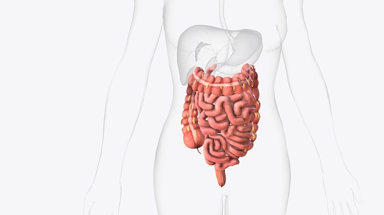 Celiac or coeliac intestine disease anatomy medical concept with normal villi and damaged small bowel lining as an autoimmune disorder of the digestion system with colon and stomach as a 3D illustration.