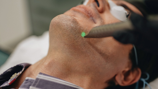 Man undergoing light peel treatment in beauty clinic