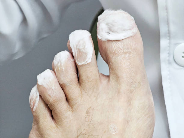 treatment with a podiatrist - pedicure podiatry beauty nail clipper 뉴스 사진 이미지