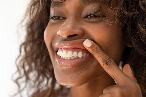 Woman showing healthy gums