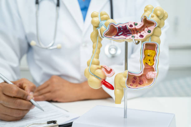 istock Intestine, appendix and digestive system, doctor holding anatomy model for study diagnosis and treatment in hospital. 2022440523