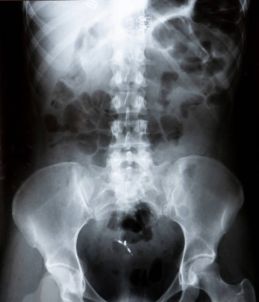 röntgenbild einer frau, die eine spirale trägt - vagina uterus human fertility x ray image stock-fotos und bilder