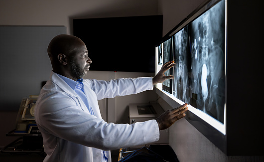 African American doctor looking at an x-ray image at the hospital - healthcare and medicine concepts