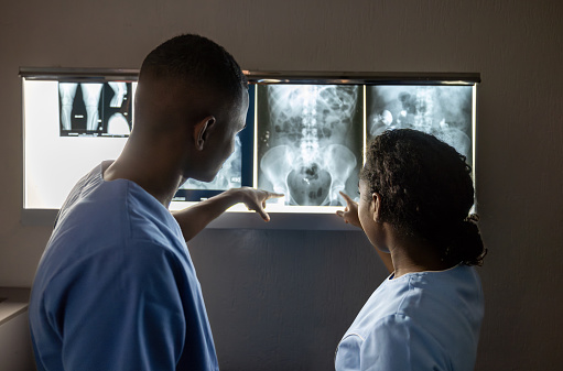 Team of African American radiologists looking at x-ray images at the hospital - healthcare and medicine concepts