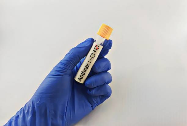 Anthrax Lab Testing 70+ Anthrax Spores Stock Photos, Pictures & Royalty-Free Images - iStock