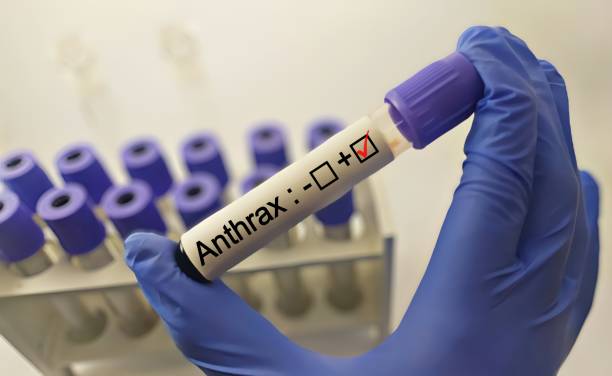 Anthrax Lab Testing 70+ Anthrax Spores Stock Photos, Pictures & Royalty-Free Images - iStock
