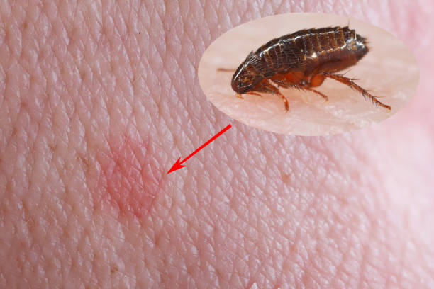 A flea biting on the skin of human hand, drinking blood and causes redness of the skin at the place of the bite. A carrier of disease-causing microorganisms. A flea biting on the skin of human hand, drinking blood and causes redness of the skin at the place of the bite. A carrier of disease-causing microorganisms. cat flea stock pictures, royalty-free photos & images