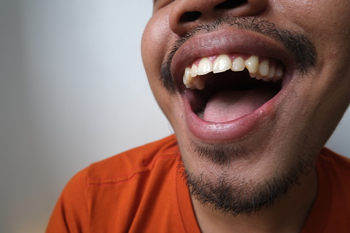 Close up of opened mouth with wide smile of Indonesian man, viewed from side, with copy space