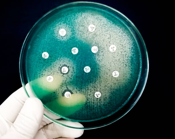 istock Antimicrobial susceptibility testing of Pseudomonas aeruginosa, mueller hinton agar plate. 2027129750