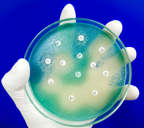 istock Antimicrobial susceptibility testing of Pseudomonas aeruginosa, mueller hinton agar plate. 2027129755