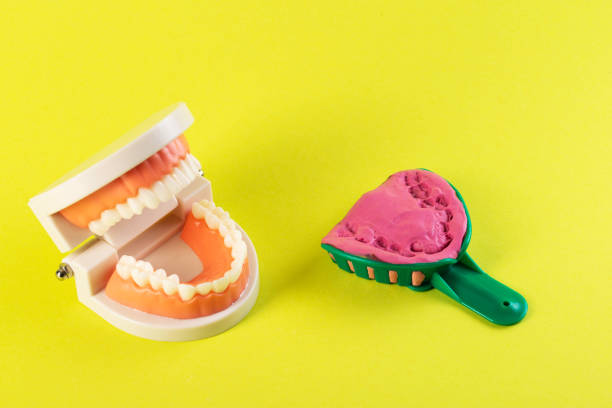 Green dental spoon for taking a dental impression in a mock-up of a dental jaw on a yellow background. Making an artificial jaw for malocclusion. Manufacturing of dental prostheses, orthodontics in dentistry. Copy space for text green dental spoon for taking a dental impression in a mock-up of a dental jaw on a yellow background. making an artificial jaw for malocclusion. manufacturing of dental prostheses, orthodontics in dentistry. copy space for text, anatomical